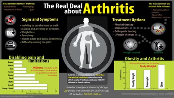 The Real Deal About Arthritis