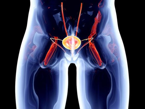 Does your bladder control your life? What you should know about your options