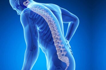 What Is Osteoporosis?